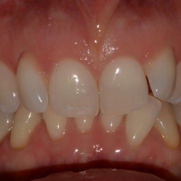 Before